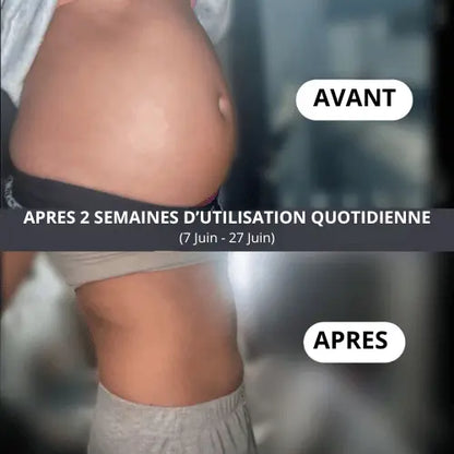Nouri. — Anti-ballonnement